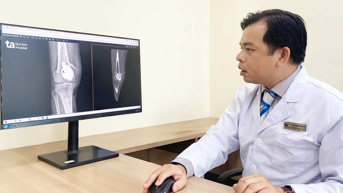 Bệnh nhân nam bị khối u ăn mòn toàn bộ khớp gối