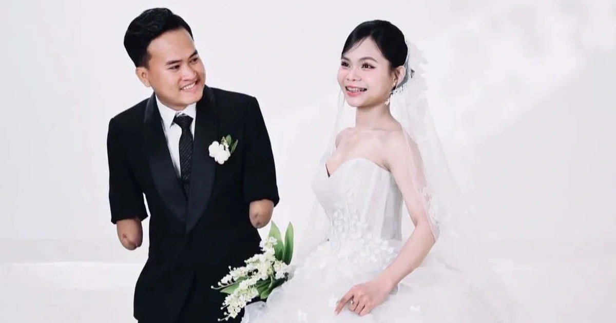 Mối tình bên người yêu xinh xắn giúp chàng trai mất hai tay mở lòng