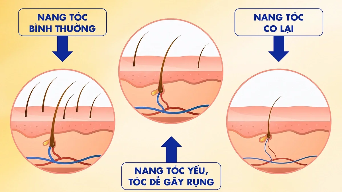 Liệu việc thay đổi màu tóc có phải nguyên nhân làm tóc gãy rụng gia tăng?